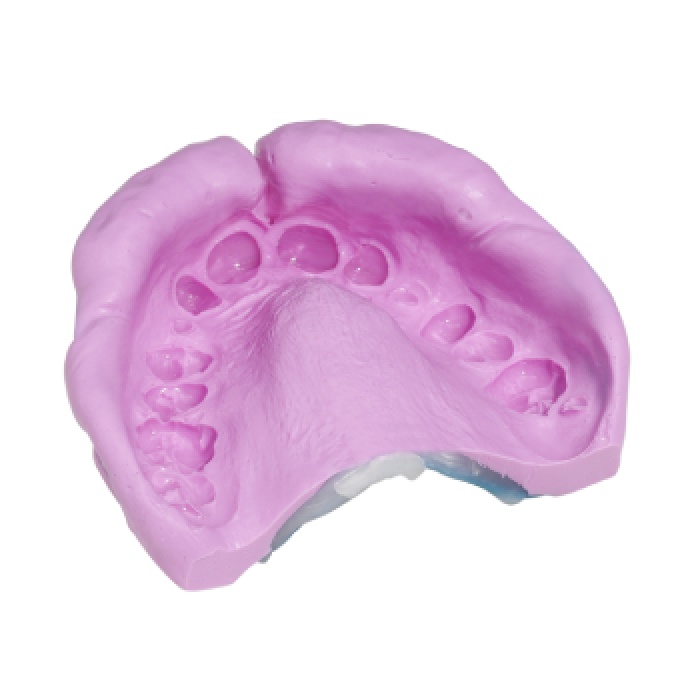 Cavex Orthotrace Aljinat 