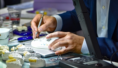 En İyi Diş Kaplama Malzemesi Hangisidir?  En İyi Diş Kaplama Malzemesi Hangisidir?