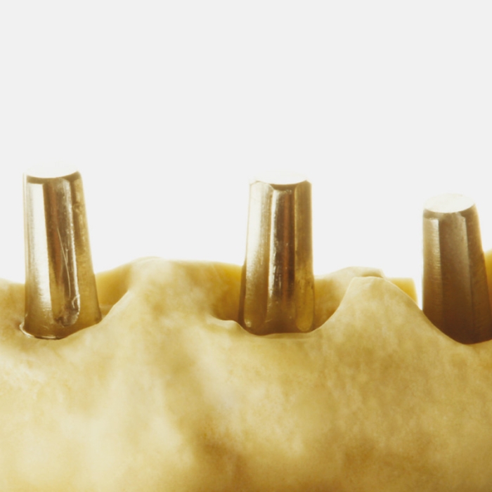 ZHERMACK ELITE ROCK Tip 4 Sert Alçı (Çöl Kumu)  ZHERMACK ELITE ROCK Tip 4 Sert Alçı (Çöl Kumu)