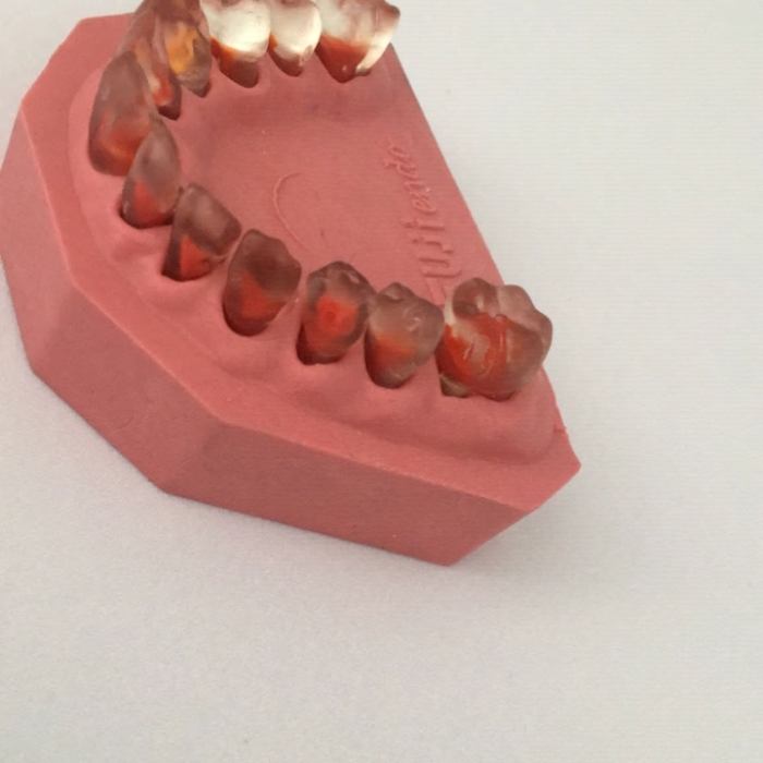 Fuji Endo Endodontik Çene Şeffaf Dişli Fuji Endo Endodontik Çene Şeffaf Dişli