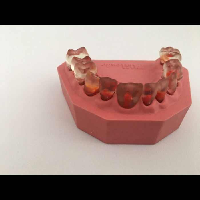 Fuji Endo Endodontik Çene Şeffaf Dişli Fuji Endo Endodontik Çene Şeffaf Dişli